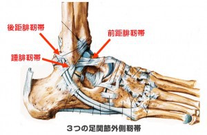 ankle_sprain_1-300x196[1]