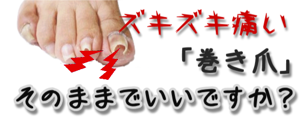 巻き爪でお悩みの方 効果バツグン セルフケア 江東区南砂と塩浜の成竹鍼灸整骨院 東砂の東洋堂鍼灸整骨院 巻き爪でお悩みの方 効果バツグン セルフケア 江東区南砂と塩浜の成竹鍼灸整骨院 東砂の東洋堂鍼灸整骨院